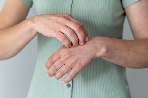 Free photo skin allergy on a person's arms