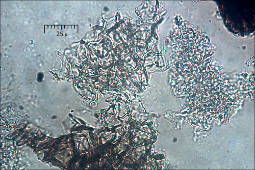 Rhizopogon-aestivus_subcortex_7M